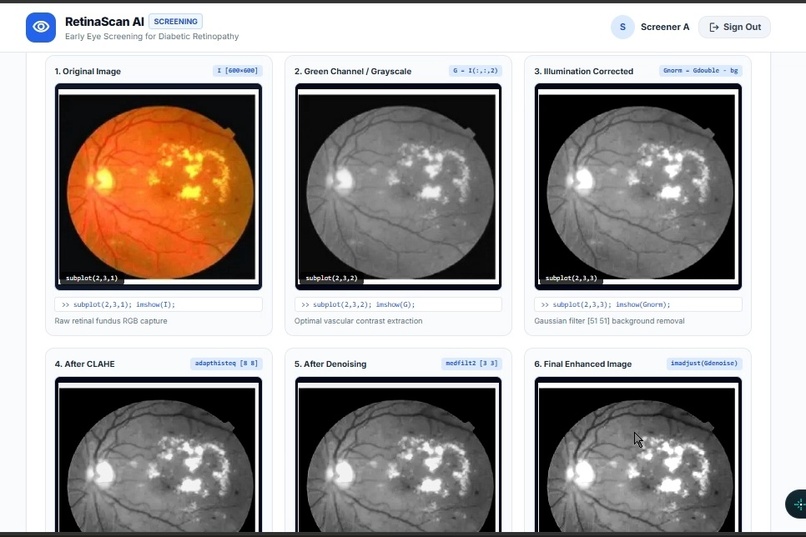 RetinaScan AI – screenshot 10