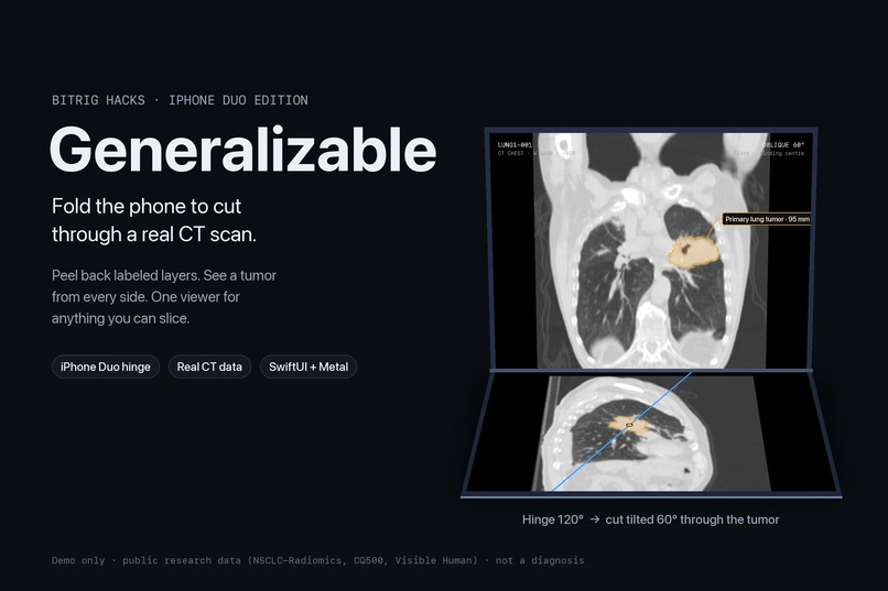 Generalizable – screenshot 1