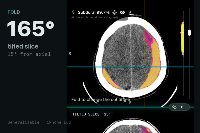 Generalizable – screenshot 4