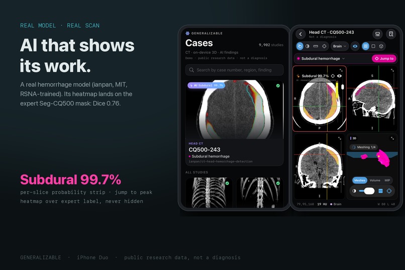 Generalizable – screenshot 5