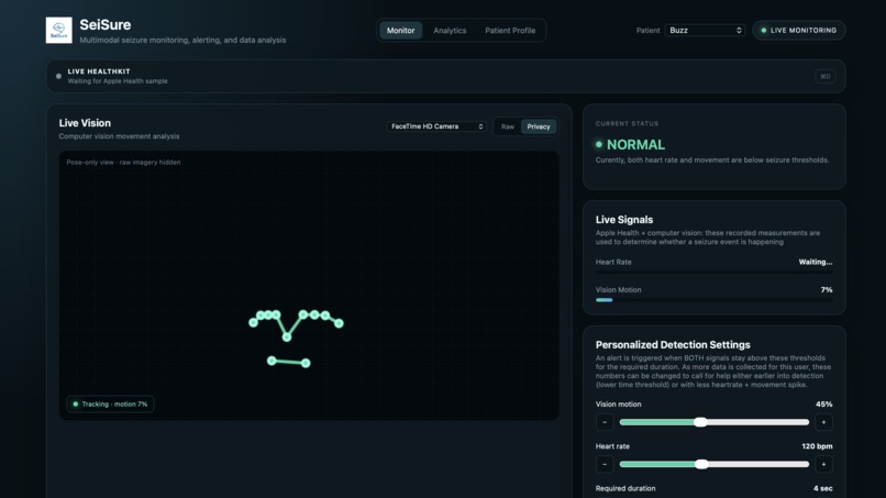 SeiSure – screenshot 1