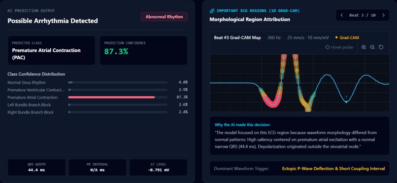 CardioAI – screenshot 5