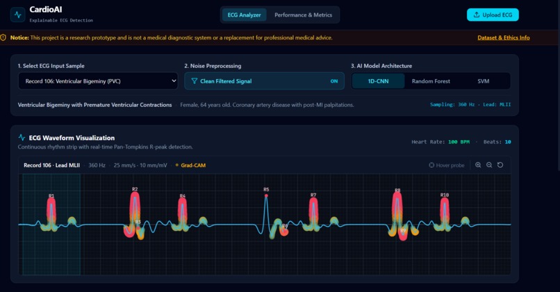CardioAI – screenshot 6