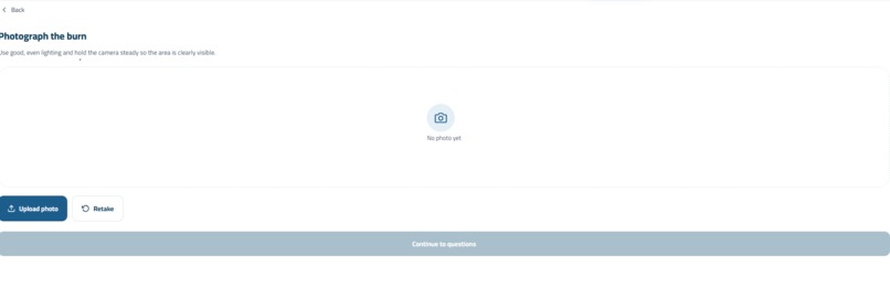 BurnCare AI – screenshot 2