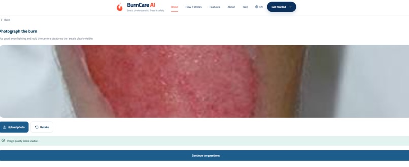 BurnCare AI – screenshot 10