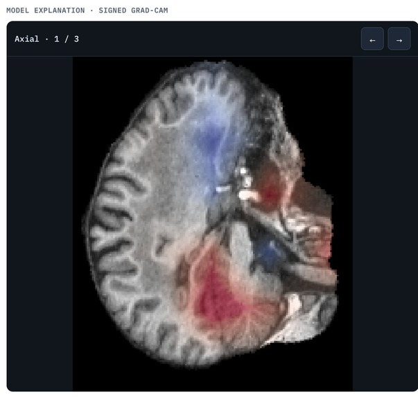 NeuroMetric: AI-Based Brain Age Prediction Clinic Dashboard – screenshot 4