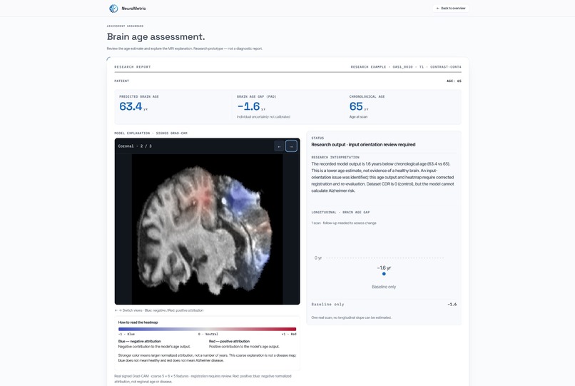 NeuroMetric: AI-Based Brain Age Prediction Clinic Dashboard – screenshot 5