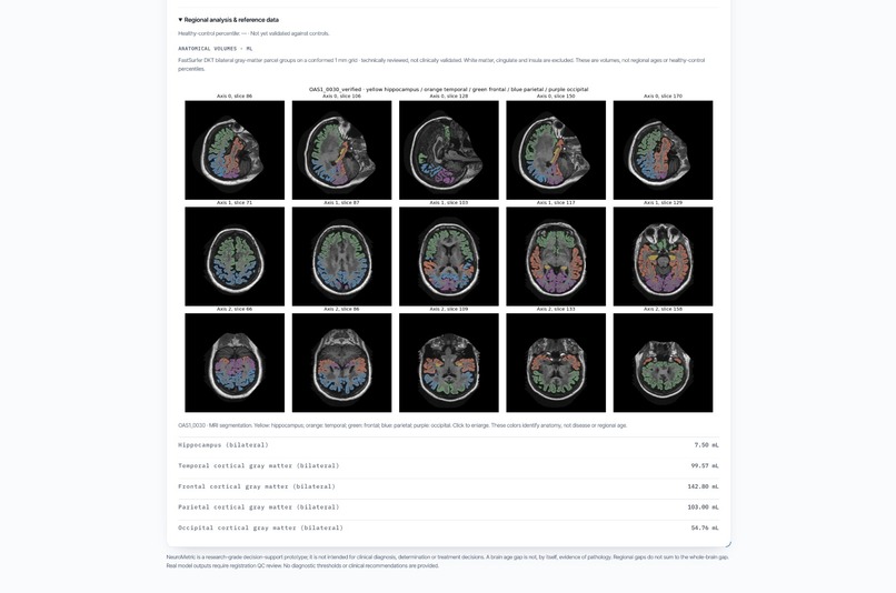 NeuroMetric: AI-Based Brain Age Prediction Clinic Dashboard – screenshot 6