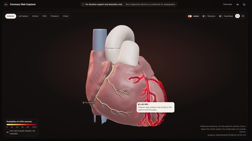 Coronary Risk Explorer – screenshot 2