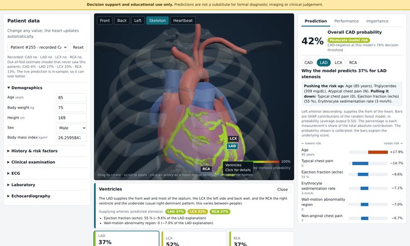 Cardio3D: Interactive 3D Coronary Risk & Stenosis Visualizer – screenshot 4