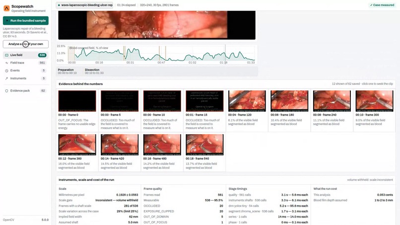Scopewatch – screenshot 3