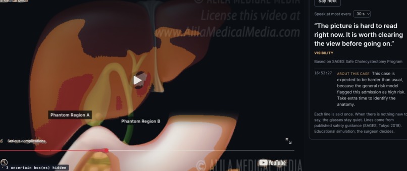 SurgiVision – screenshot 1