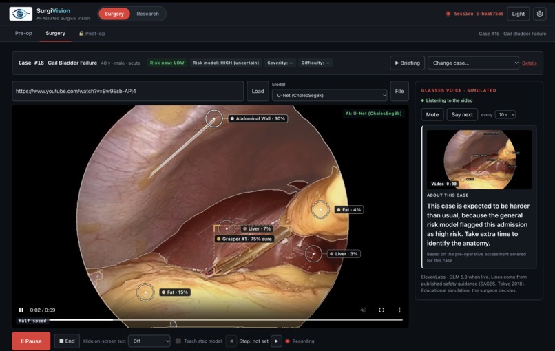 SurgiVision – screenshot 5