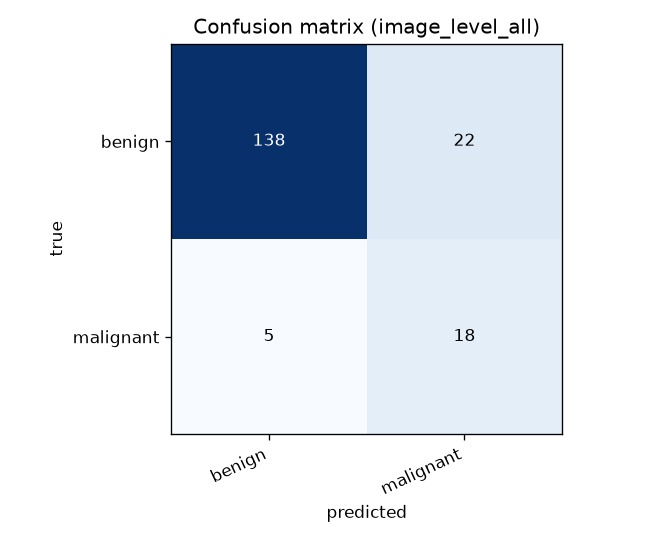 Lumen Colonoscopy AI – screenshot 5