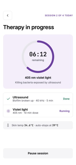 Amethyst – screenshot 4