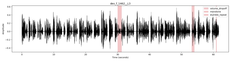 SpeechLens: contrastive speech analytics – screenshot 2