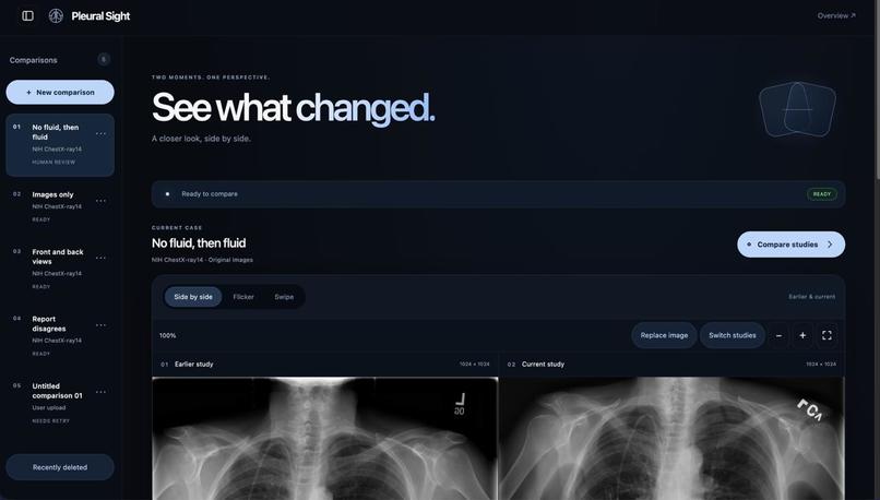 Pleural Sight – screenshot 3