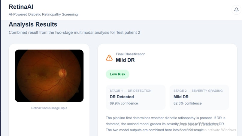 Multimodal ViT Framework for DR Detection Severity Grading  – screenshot 2
