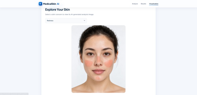 MedicalSkin AI – screenshot 4