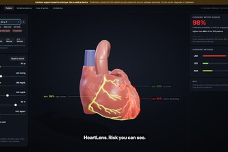 HeartLens