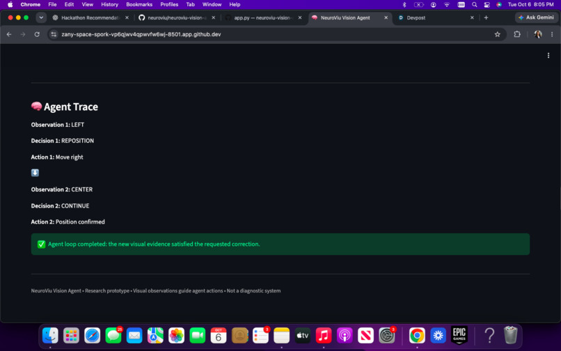 NeuroViu Vision Agent – screenshot 1