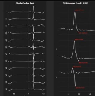 Cardio Vision – screenshot 1