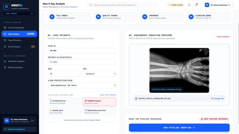 FractureLens AI – screenshot 1