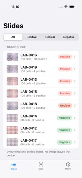 Iba Lens – screenshot 3