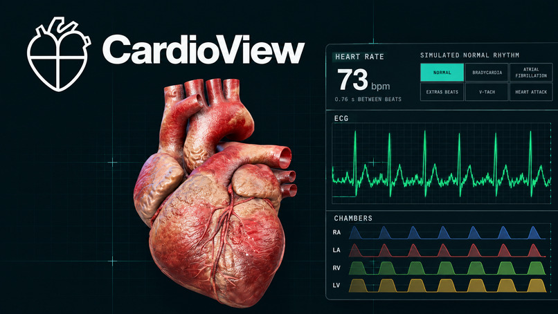 CardioView – screenshot 2