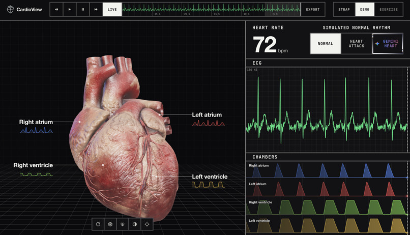 CardioView – screenshot 3
