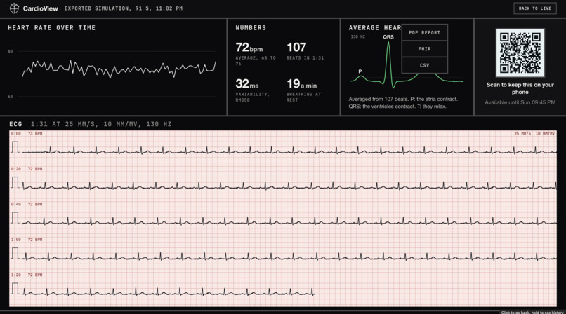 CardioView – screenshot 4