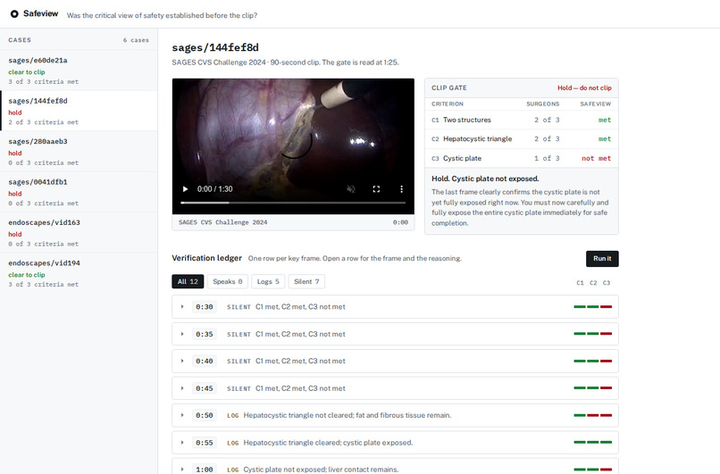 Safeview – screenshot 1