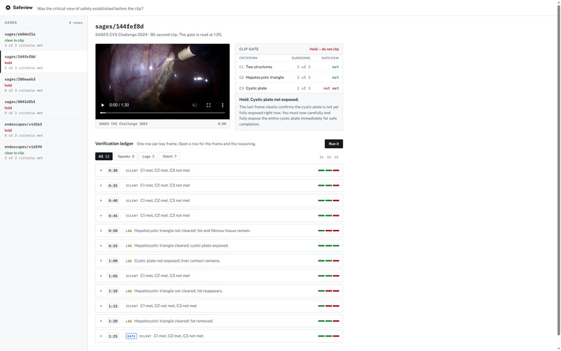 Safeview – screenshot 2