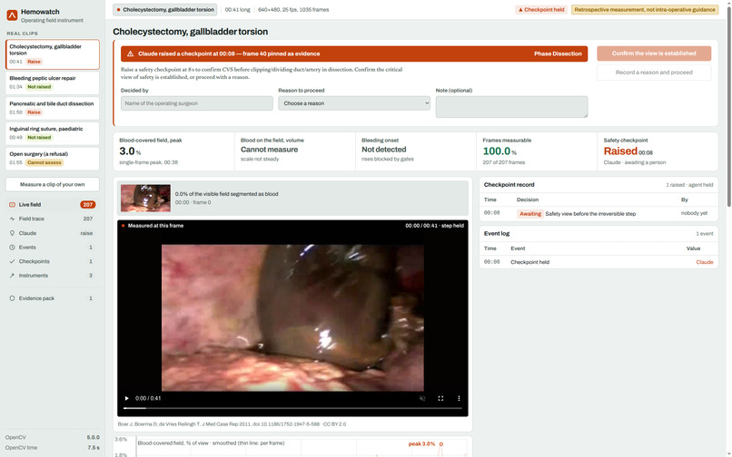 Hemowatch – screenshot 1