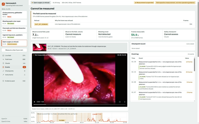 Hemowatch – screenshot 2