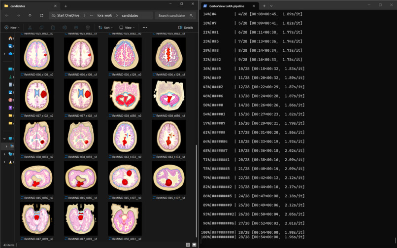 CortexView – screenshot 1