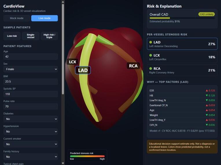 CardioView — Explainable Cardiac Risk in 3D – screenshot 2