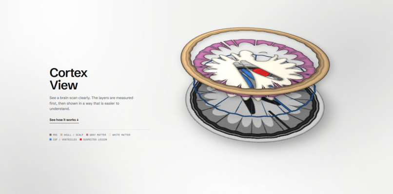 CortexView – screenshot 2