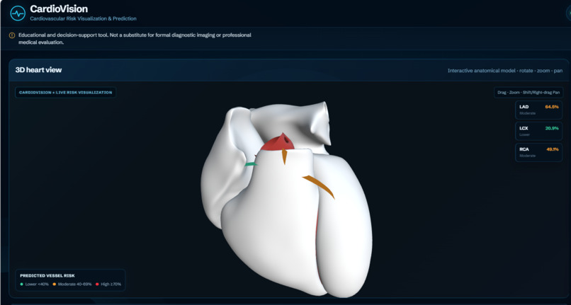 CardioVision – screenshot 2