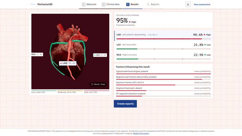 Perfusion3D: Spatial Coronary Ischemia Tool – screenshot 5