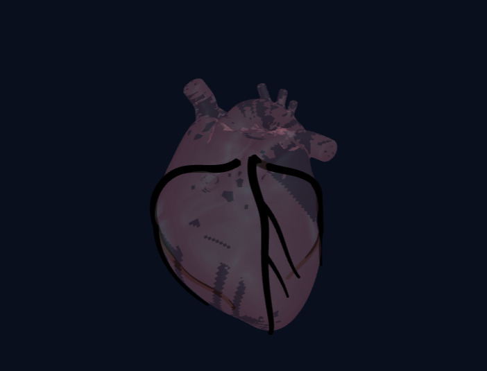 PulseAI: 3D Heart Risk & Stenosis Predictor – screenshot 2
