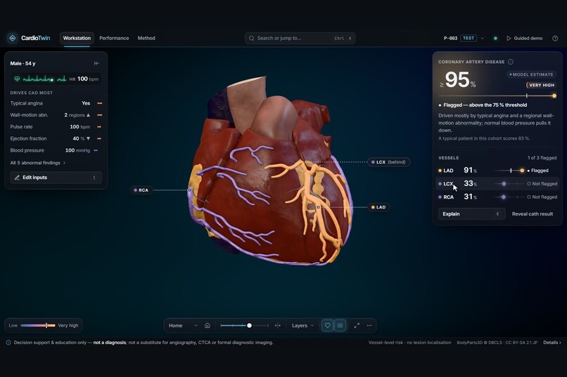 CardioTwin – screenshot 2