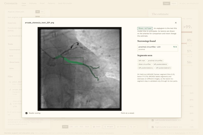Coronaria – screenshot 2