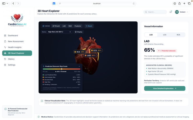 CardioVision AI – screenshot 4