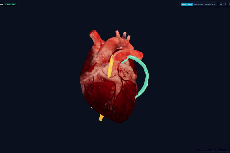 CardioVision AI – screenshot 2