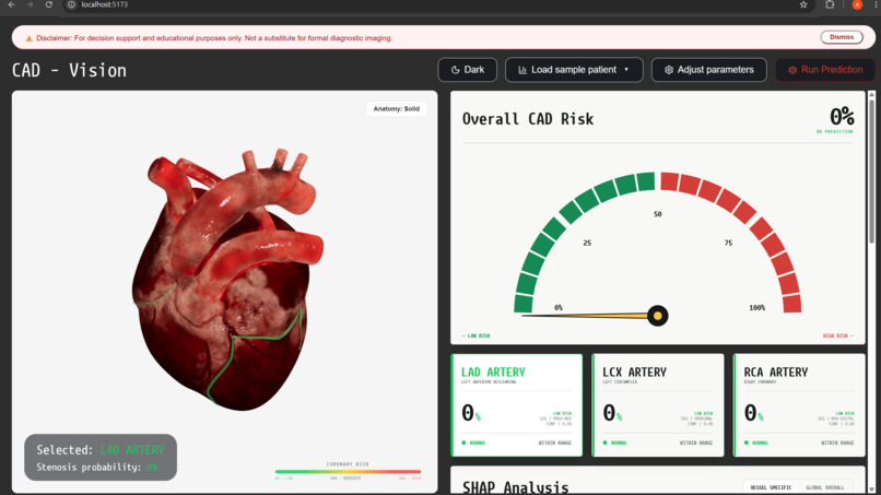 CAD-Vision – screenshot 1