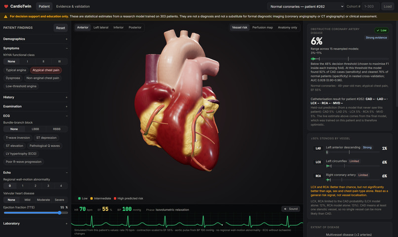 Cardiac_digital_twin – screenshot 6