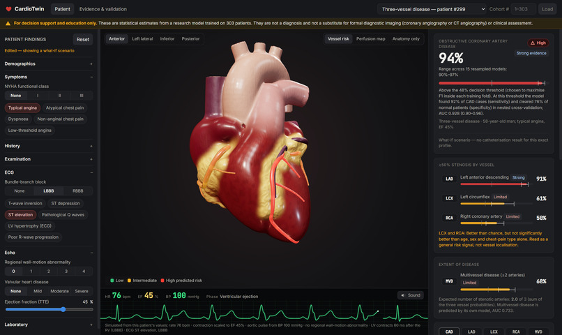 Cardiac_digital_twin – screenshot 5