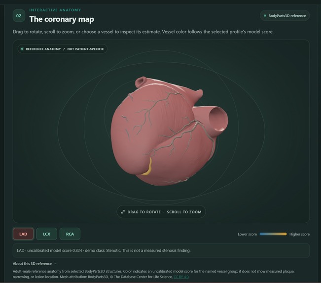 CardioAtlas – screenshot 10