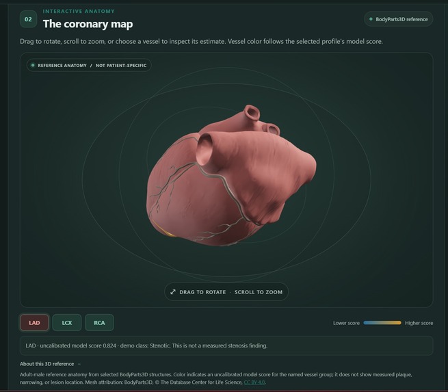 CardioAtlas – screenshot 11